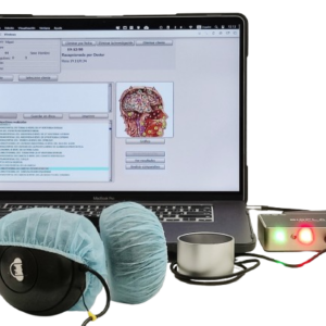 BIORRESONANCIA CUÁNTICA - análisis